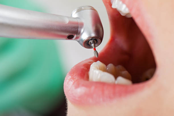Best Emergency Treatment for Oral Infections in Urbandale, IA